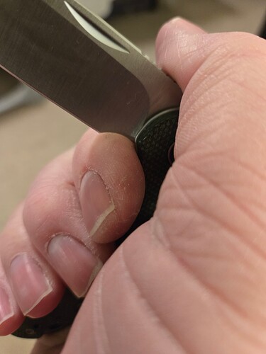 17411385328435412590774819992963